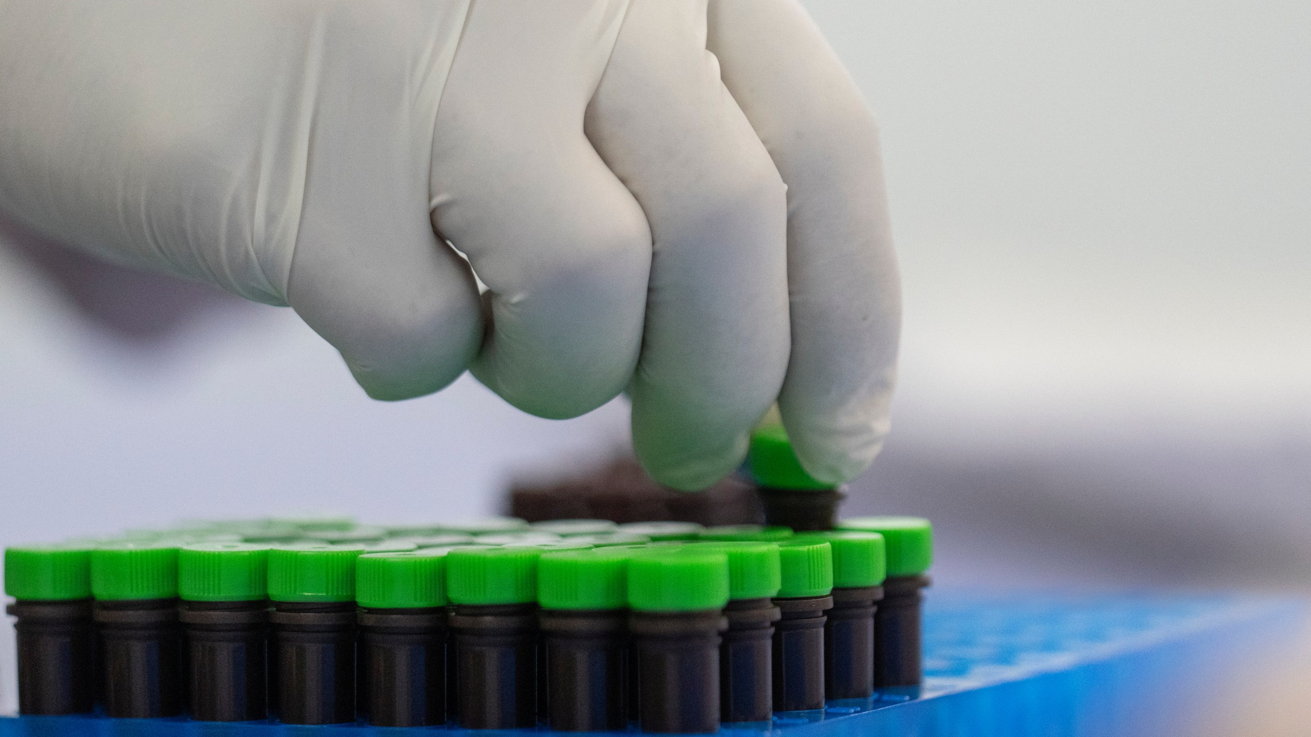 A view of mpox test kits is displayed in Moldiag, a biotechnology startup, in Tamesna, Morocco, Thursday, Nov. 28, 2024. (AP Photo/Mosa'ab Elshamy)