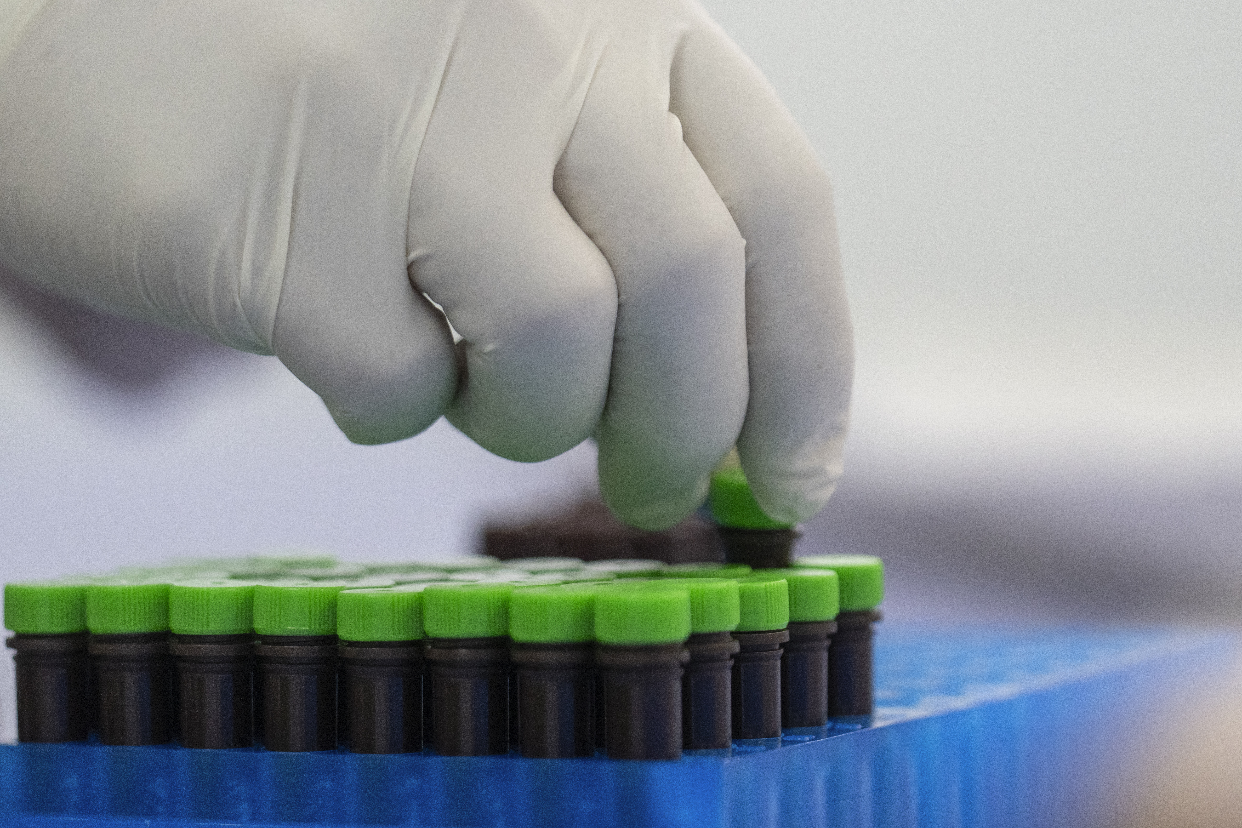 A view of mpox test kits is displayed in Moldiag, a biotechnology startup, in Tamesna, Morocco, Thursday, Nov. 28, 2024. (AP Photo/Mosa'ab Elshamy)