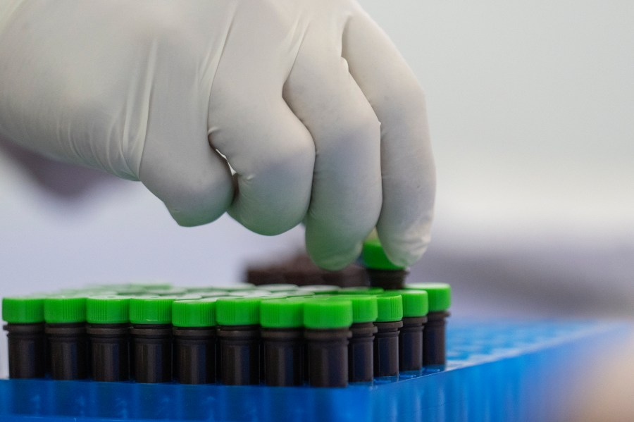 A view of mpox test kits is displayed in Moldiag, a biotechnology startup, in Tamesna, Morocco, Thursday, Nov. 28, 2024. (AP Photo/Mosa'ab Elshamy)