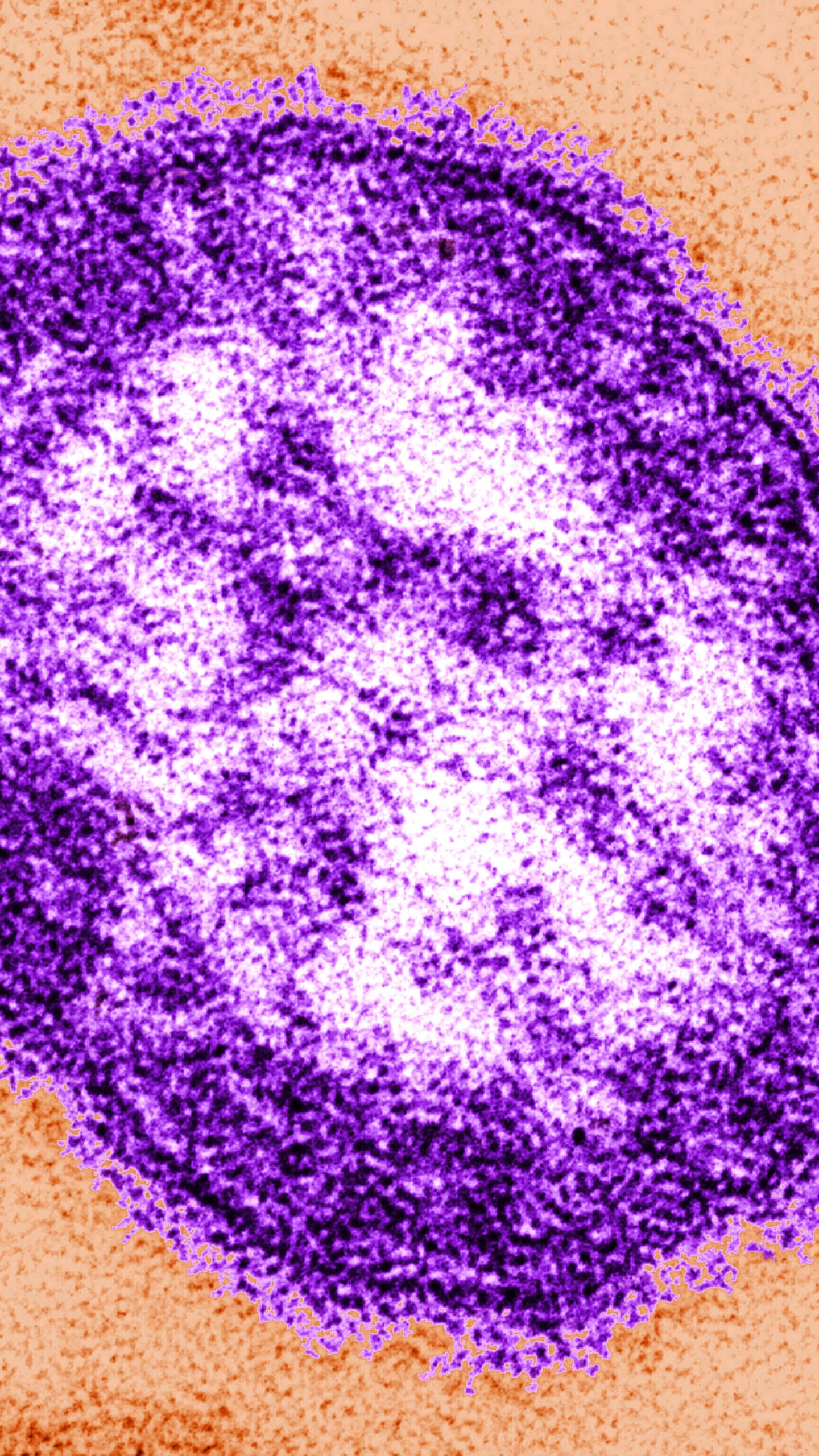 FILE - This undated image made available by the Centers for Disease Control and Prevention on Feb. 4, 2015 shows an electron microscope image of a measles virus particle, center. (Cynthia Goldsmith/Centers for Disease Control and Prevention via AP)