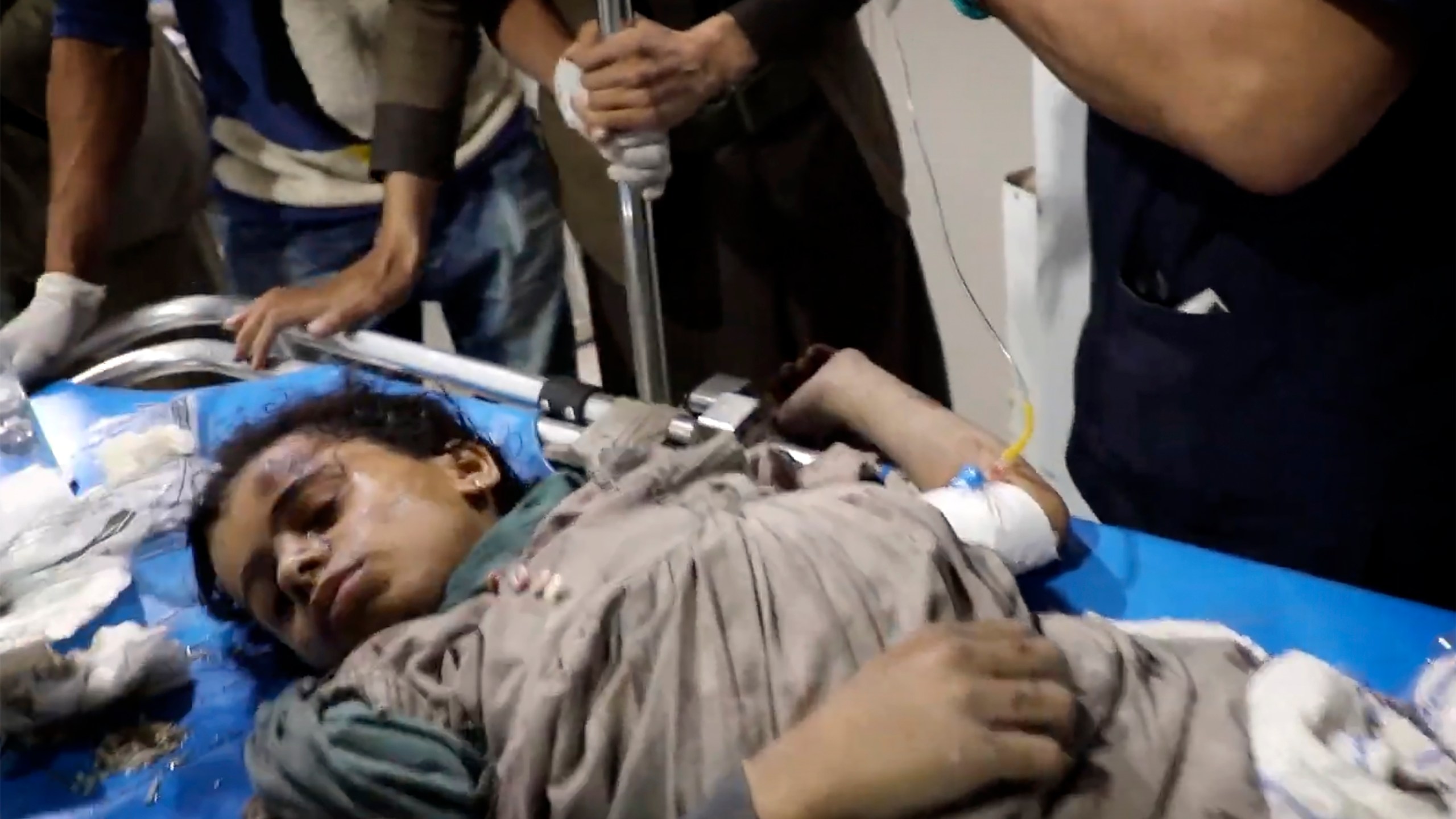 In this photo taken from video released by Ansar Allah Media Office via Al Masirah TV channel shows a wounded child being taken for treatment at a hospital in Saada, Yemen, Saturday, March 15, 2025 following airstrikes over multiple targets in the country. The Houthi-run Health Ministry said the overnight strikes killed at least 31 people, including women and children, and wounded over 100 in the capital of Sanaa and the northern province of Saada, the rebels' stronghold on the border with Saudi Arabia.( Al Masirah TV via AP)