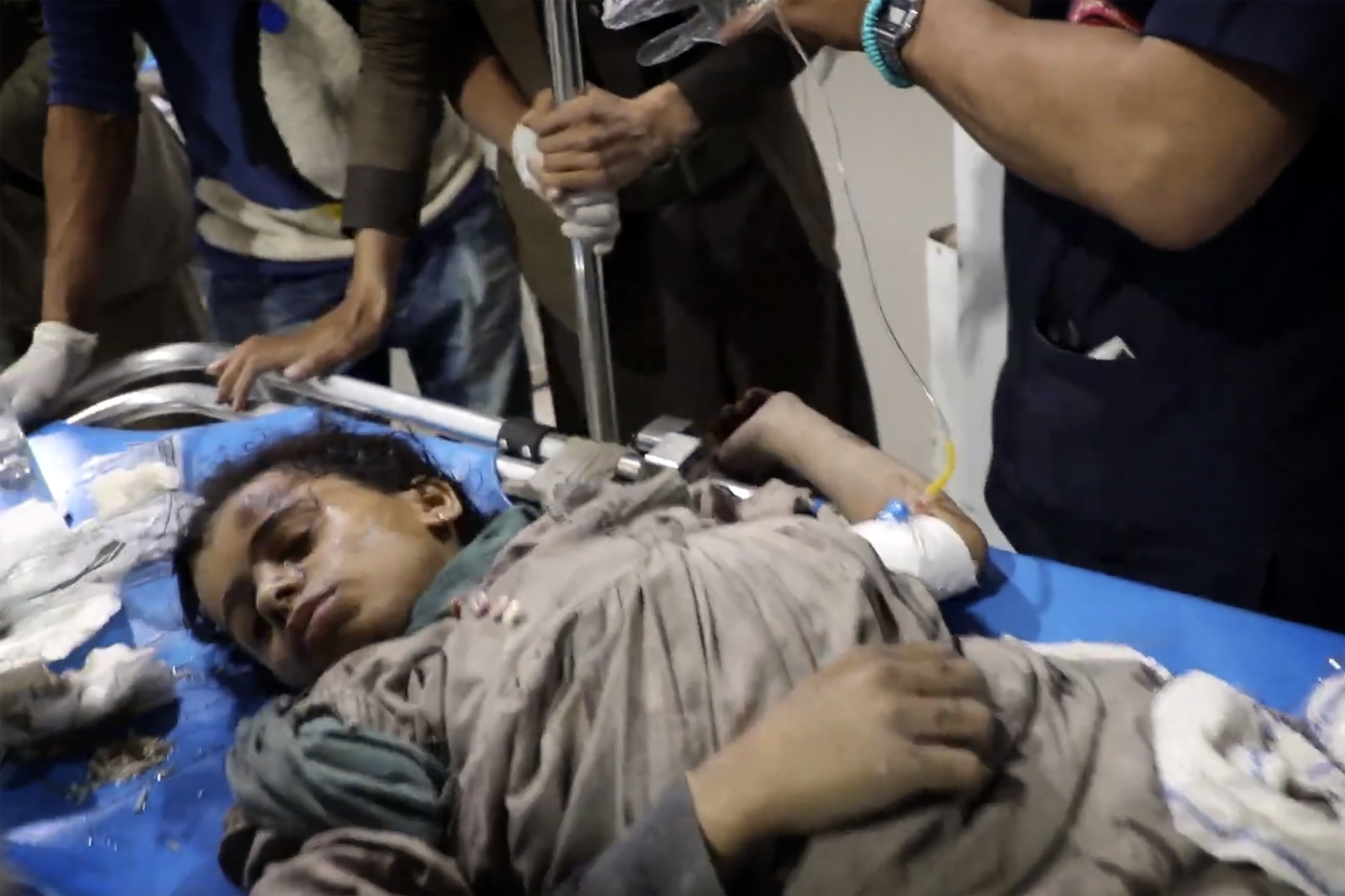 In this photo taken from video released by Ansar Allah Media Office via Al Masirah TV channel shows a wounded child being taken for treatment at a hospital in Saada, Yemen, Saturday, March 15, 2025 following airstrikes over multiple targets in the country. The Houthi-run Health Ministry said the overnight strikes killed at least 31 people, including women and children, and wounded over 100 in the capital of Sanaa and the northern province of Saada, the rebels' stronghold on the border with Saudi Arabia.( Al Masirah TV via AP)